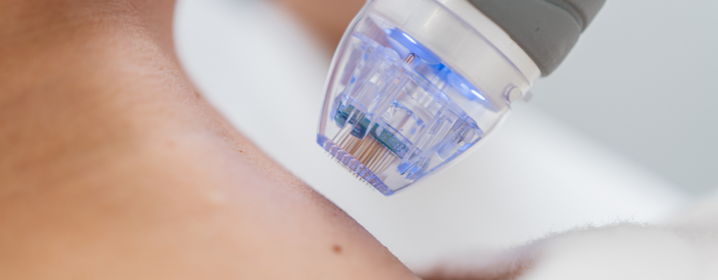 Mikroadatinė terapija