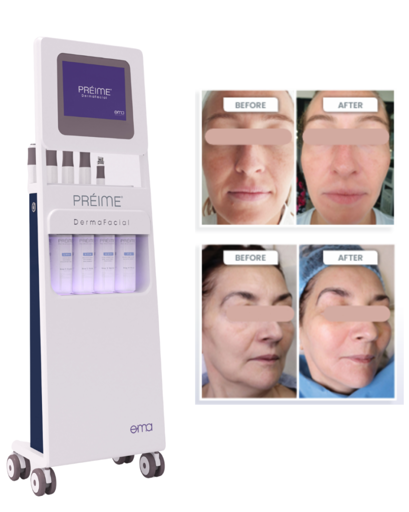 Preime dermafacial procedūros Hollywood Glow.